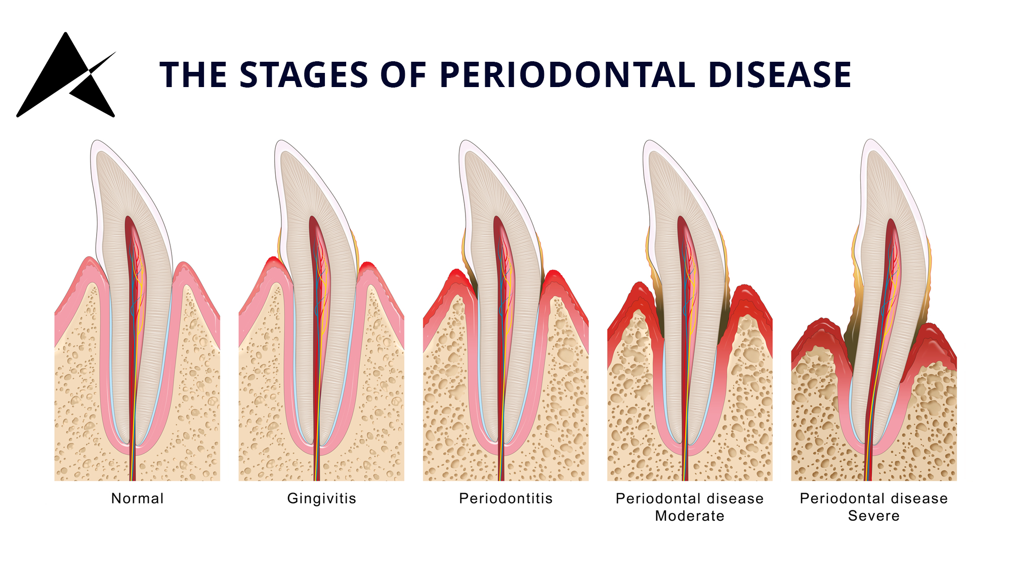white fillings in Cork