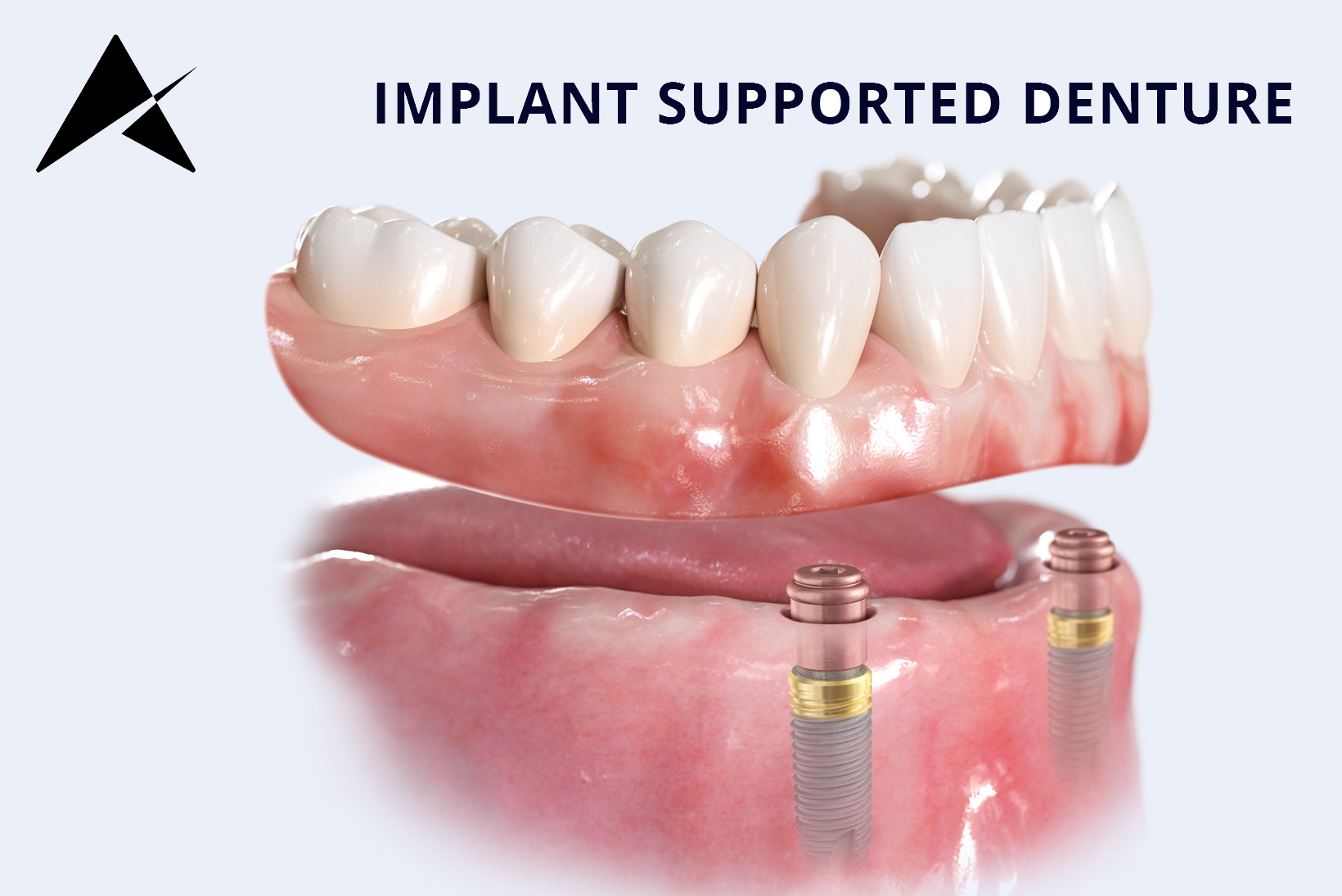 dentures in cork