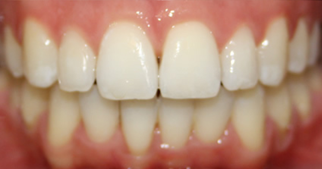 Airport Dental Implant Centre Cork