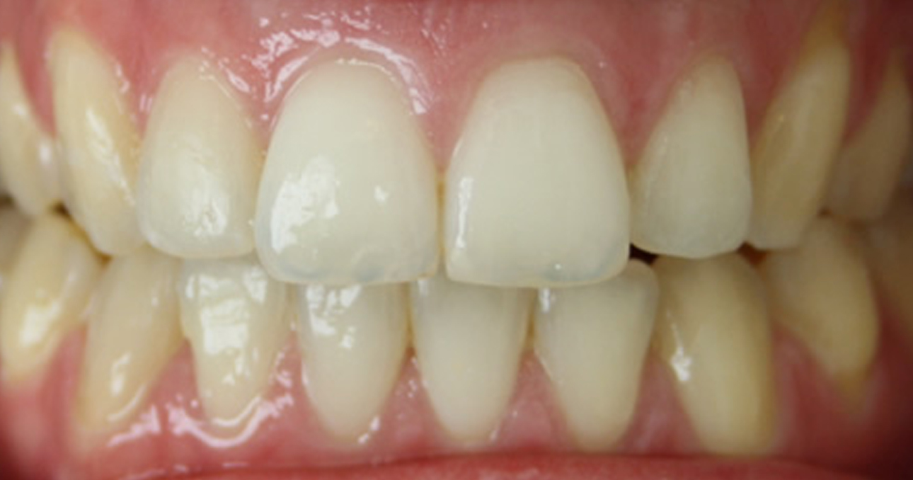 Airport Dental Implant Centre Cork