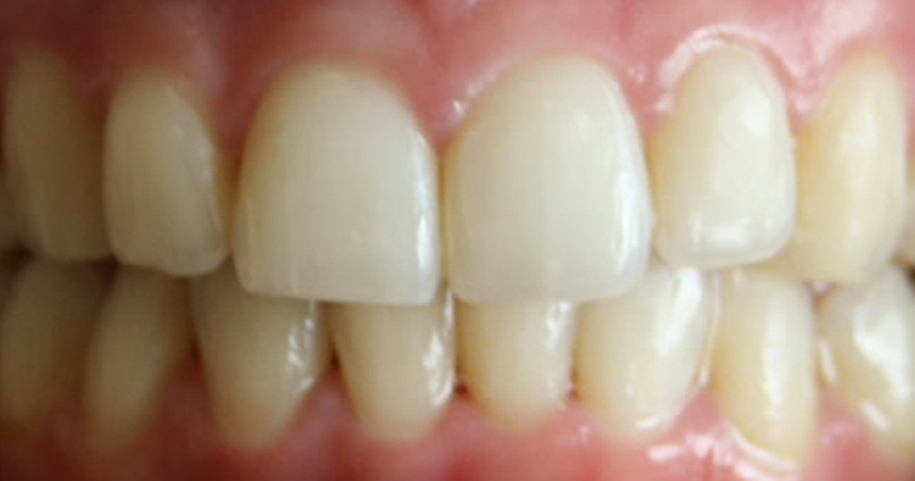 Airport Dental Implant Centre Cork