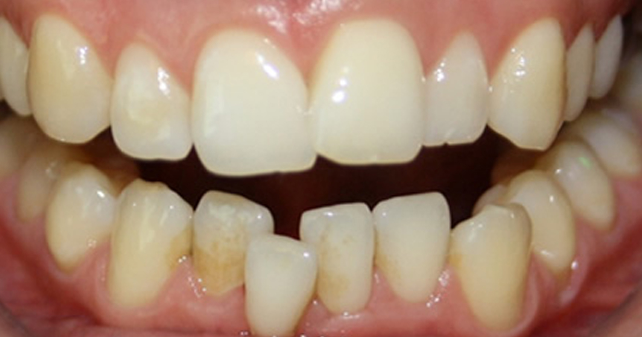 Airport Dental Implant Centre Cork